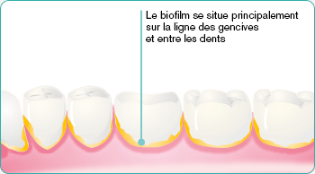 explore-image-oral-care-vap-facts-2-FR.png
